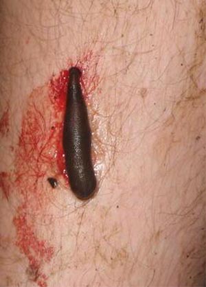 The Worm